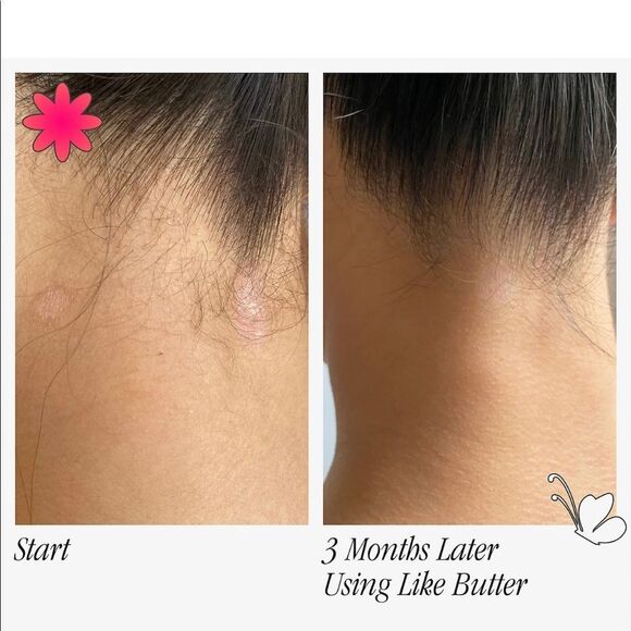 Like Butter Mask For Dry, Sensitive & Eczema-prone Skin - Picture 2 of 4